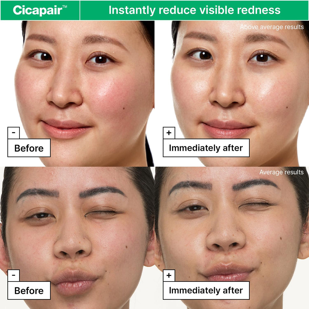 Centella Asiatica extract powers soothing in Dr.Jart+ Cicapair formula.