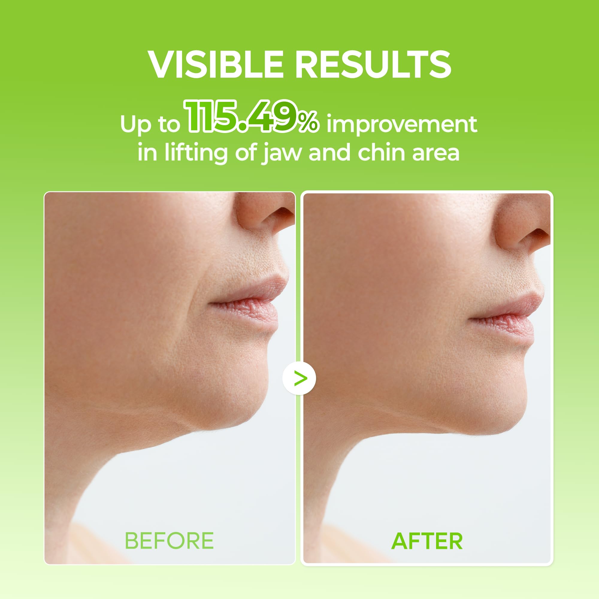 Ear-hook design demonstrates upward tension along the jawline.
