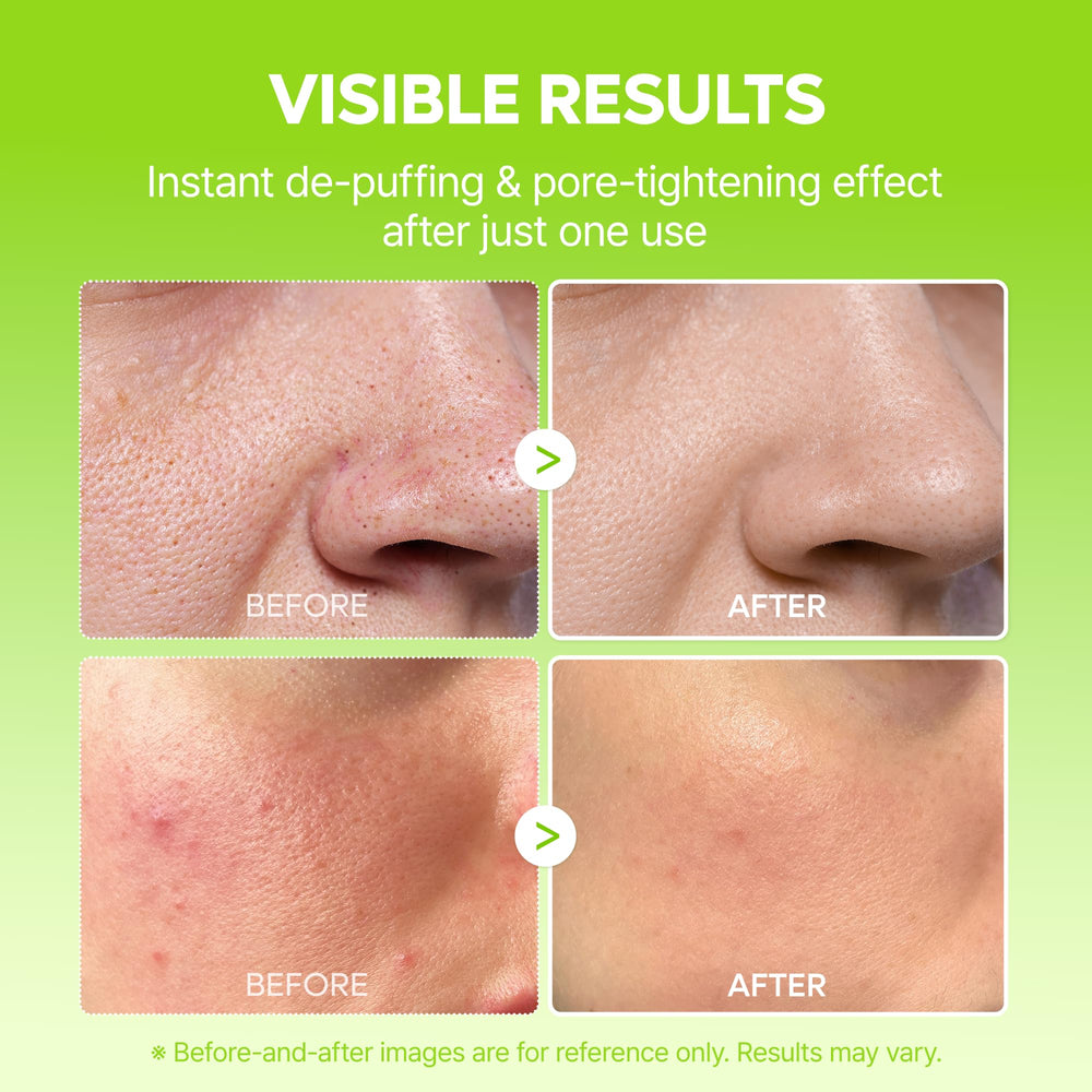 Dr.Melaxin Cactox puffiness reduction mist used daily after cleansing.