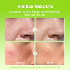 Dr.Melaxin Cactox puffiness reduction mist used daily after cleansing.