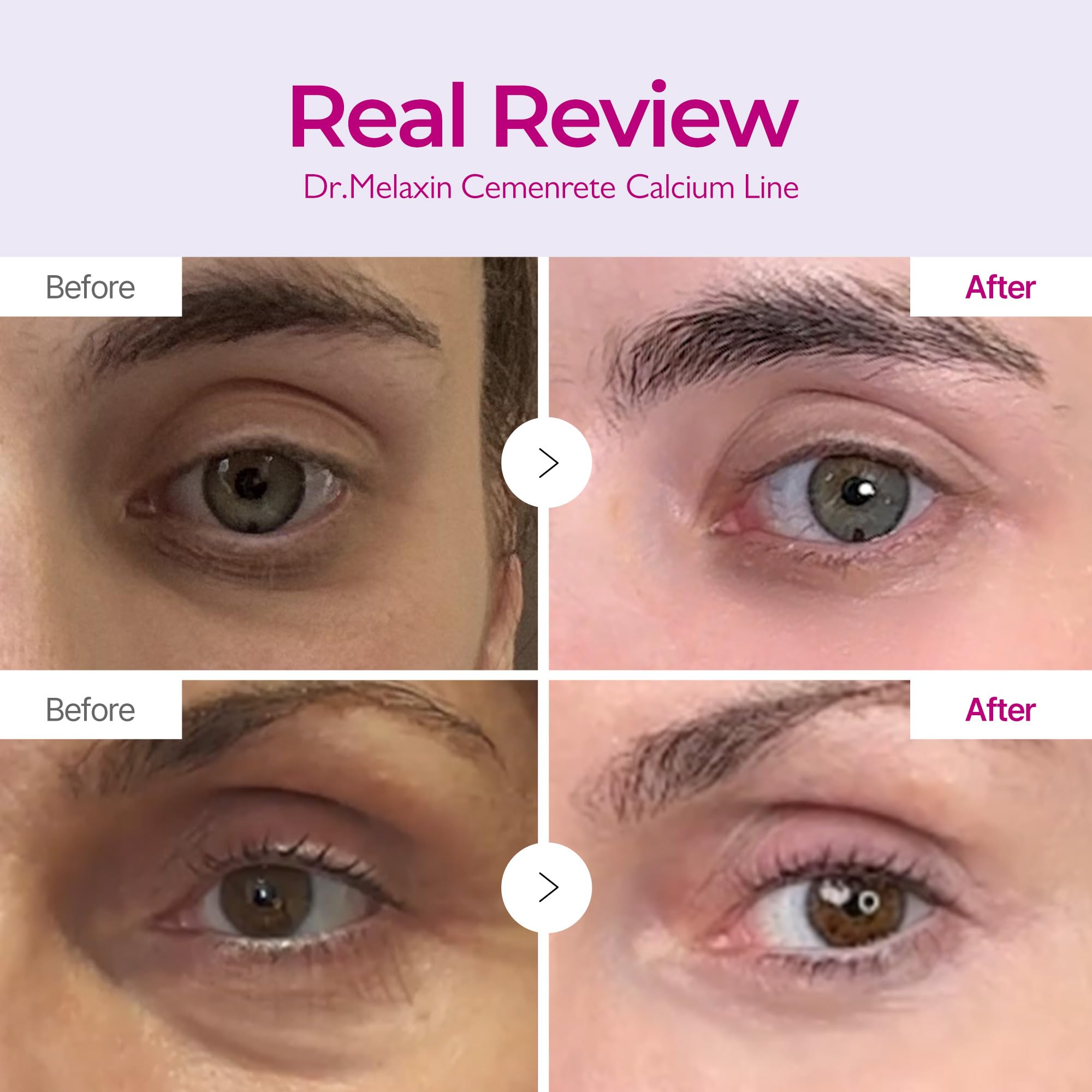 Close-up of Dr.Melaxin cream texture showing rich, smooth application.