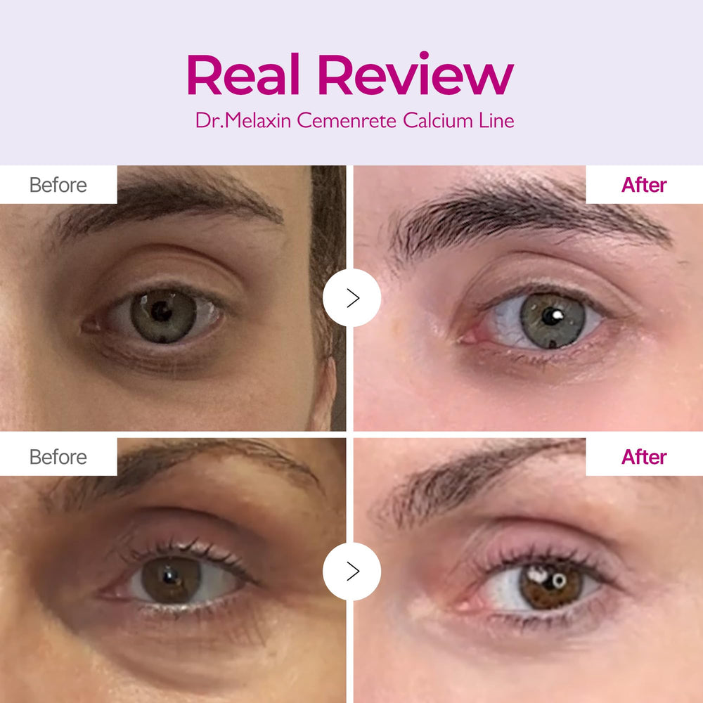 Close-up of Dr.Melaxin cream texture showing rich, smooth application.