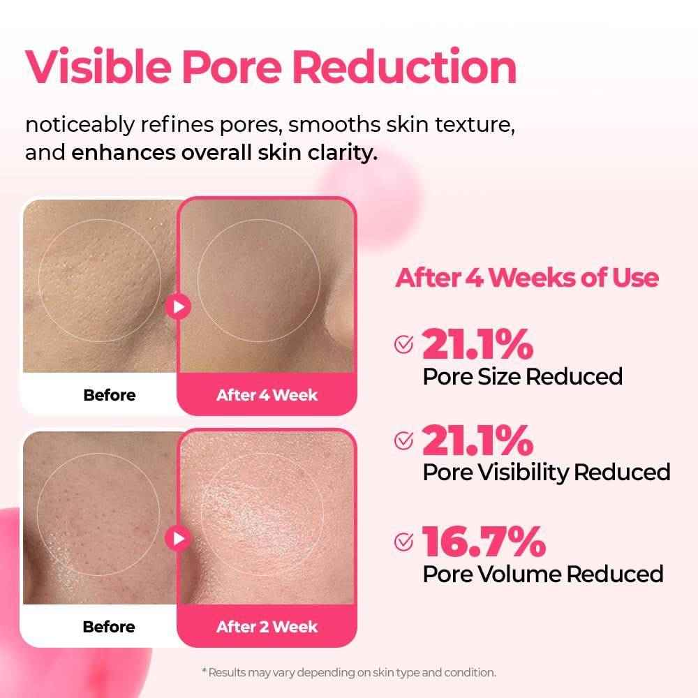 Dr.Melaxin Cyano Pink Spicule Serum pores closeup shows refinement