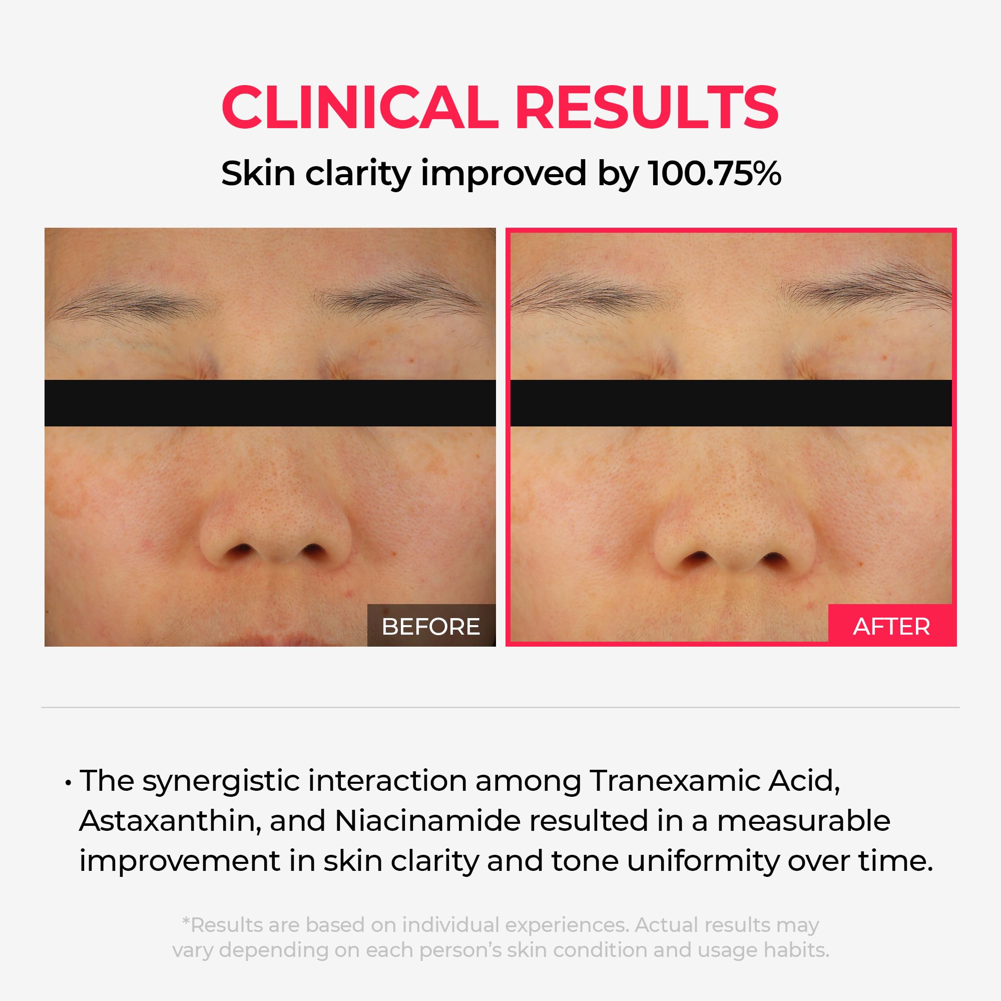 Dr.Melaxin TX Astaxanthin mask spread on the face showing even tone prep