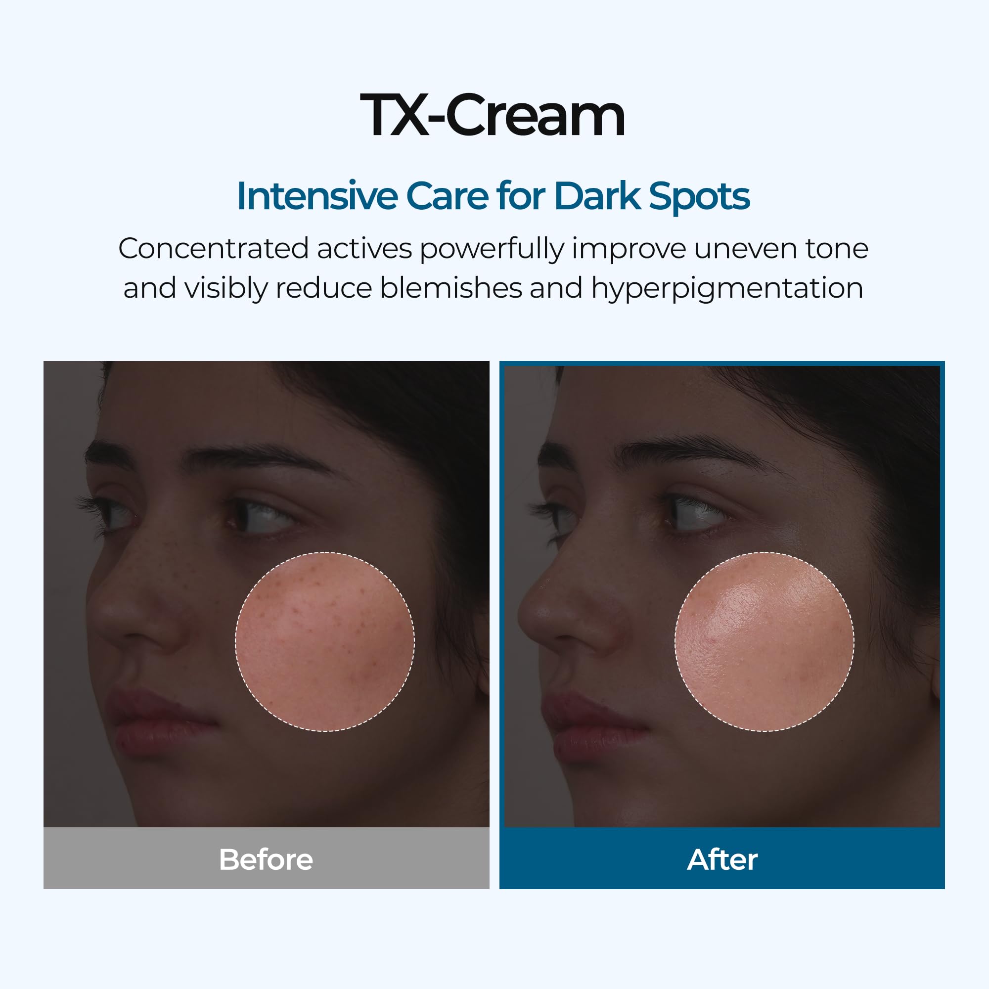 Dr.Melaxin TX Cream jar closeup showing creamy texture and hydration.