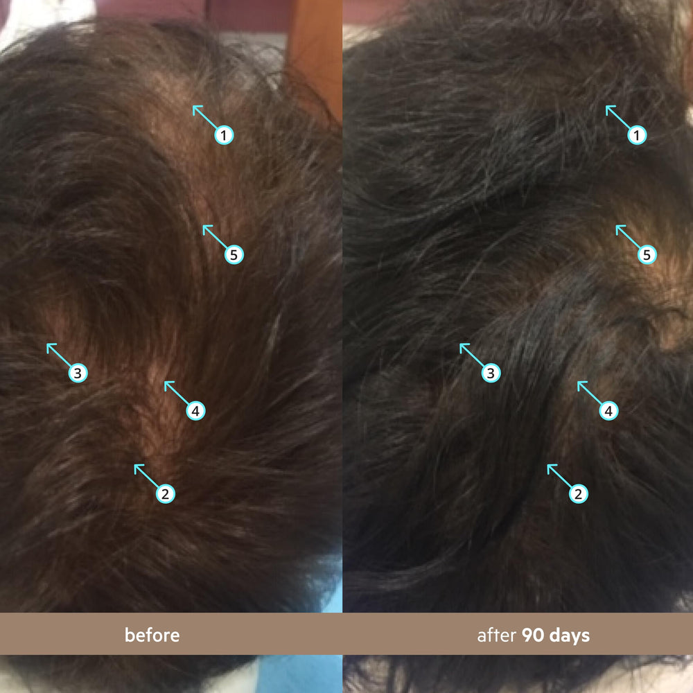 DS Laboratories Spectral Men’s Hair Density Serum in hand shows lightweight texture