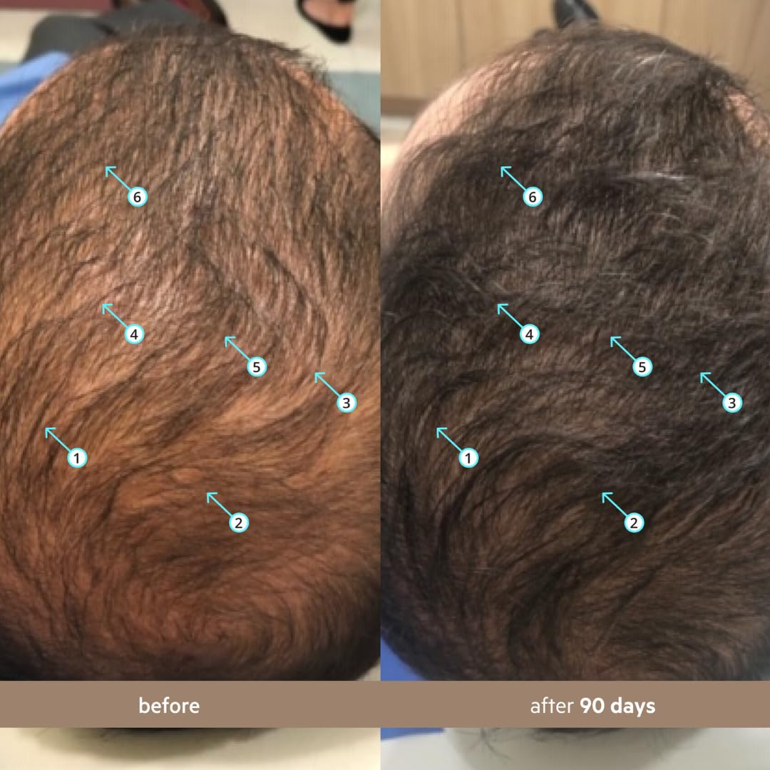 DS Laboratories Spectral Men’s Hair Density Serum applied to the scalp for fuller look