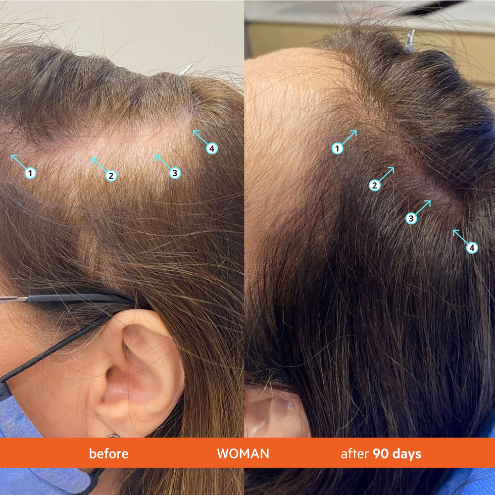 Spectral Men's Serum being applied to scalp for volumizing, non-greasy finish.