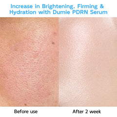 Graphic highlights six hyaluronic acid derivatives in the Dumie serum.