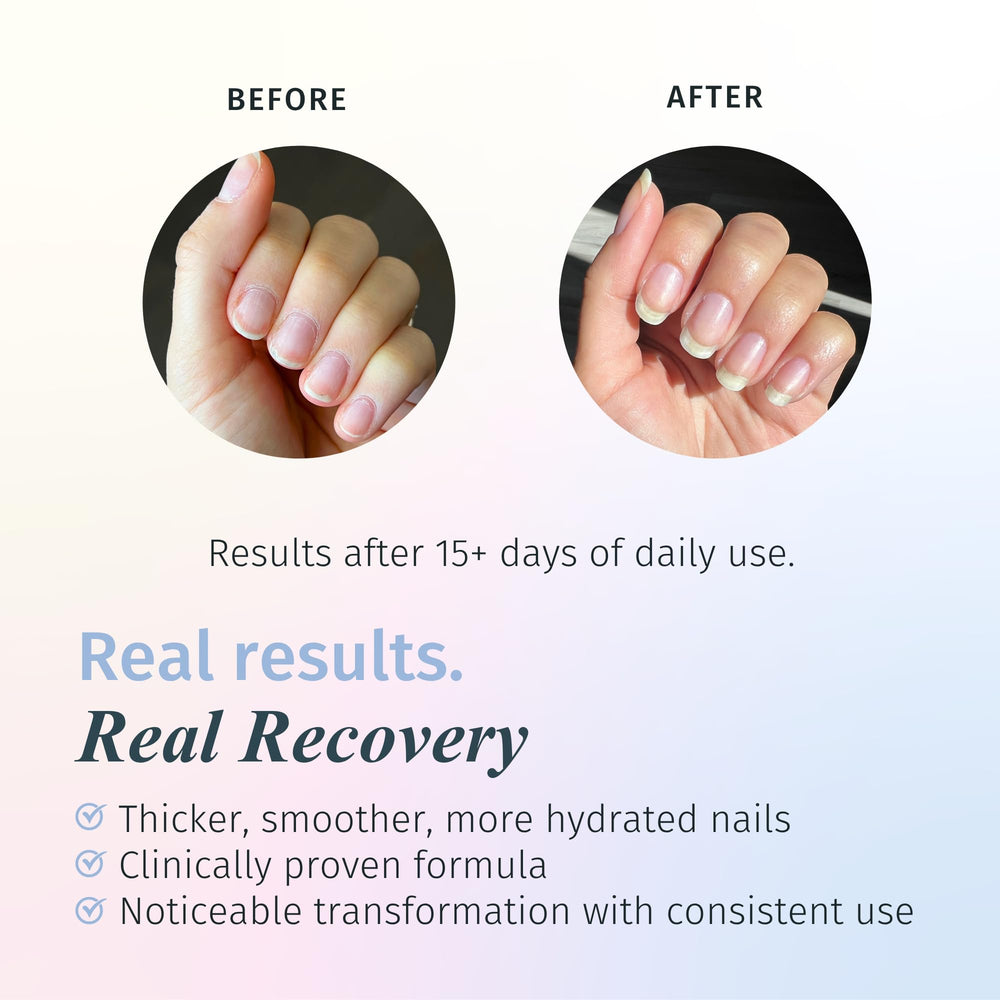 Duri Rejuvacote 1 bottle pour demonstrates easy application on nails.