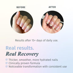 Duri Rejuvacote 1 bottle pour demonstrates easy application on nails.
