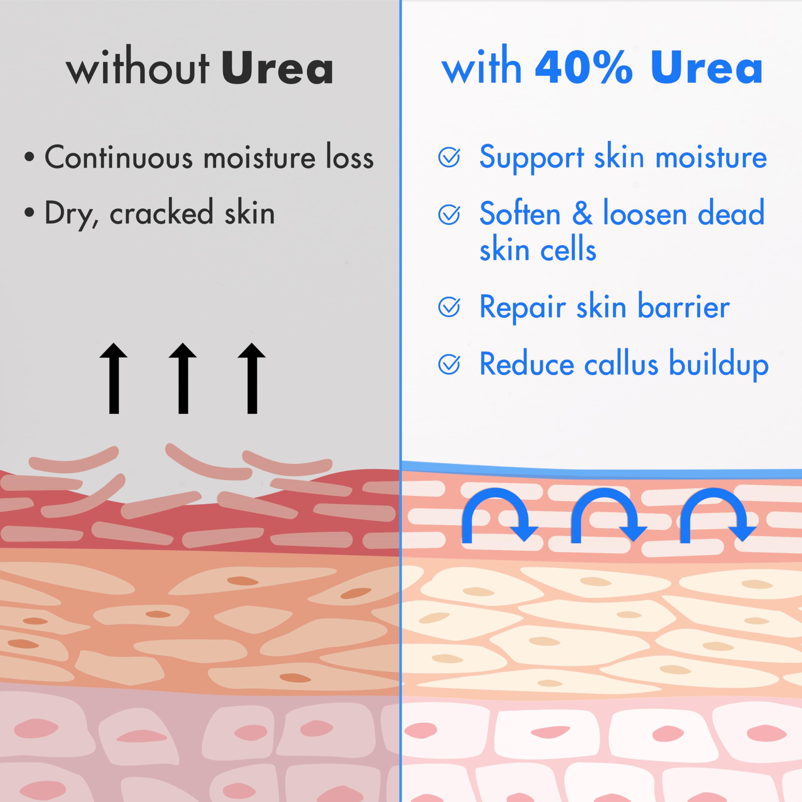 Close-up of Ebanel Urea Cream on foot skin showing hydration.