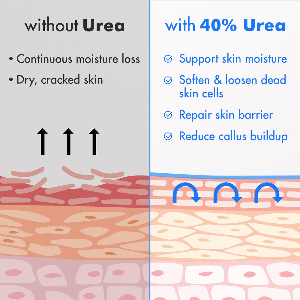 Close-up of Ebanel Urea Cream on foot skin showing hydration.