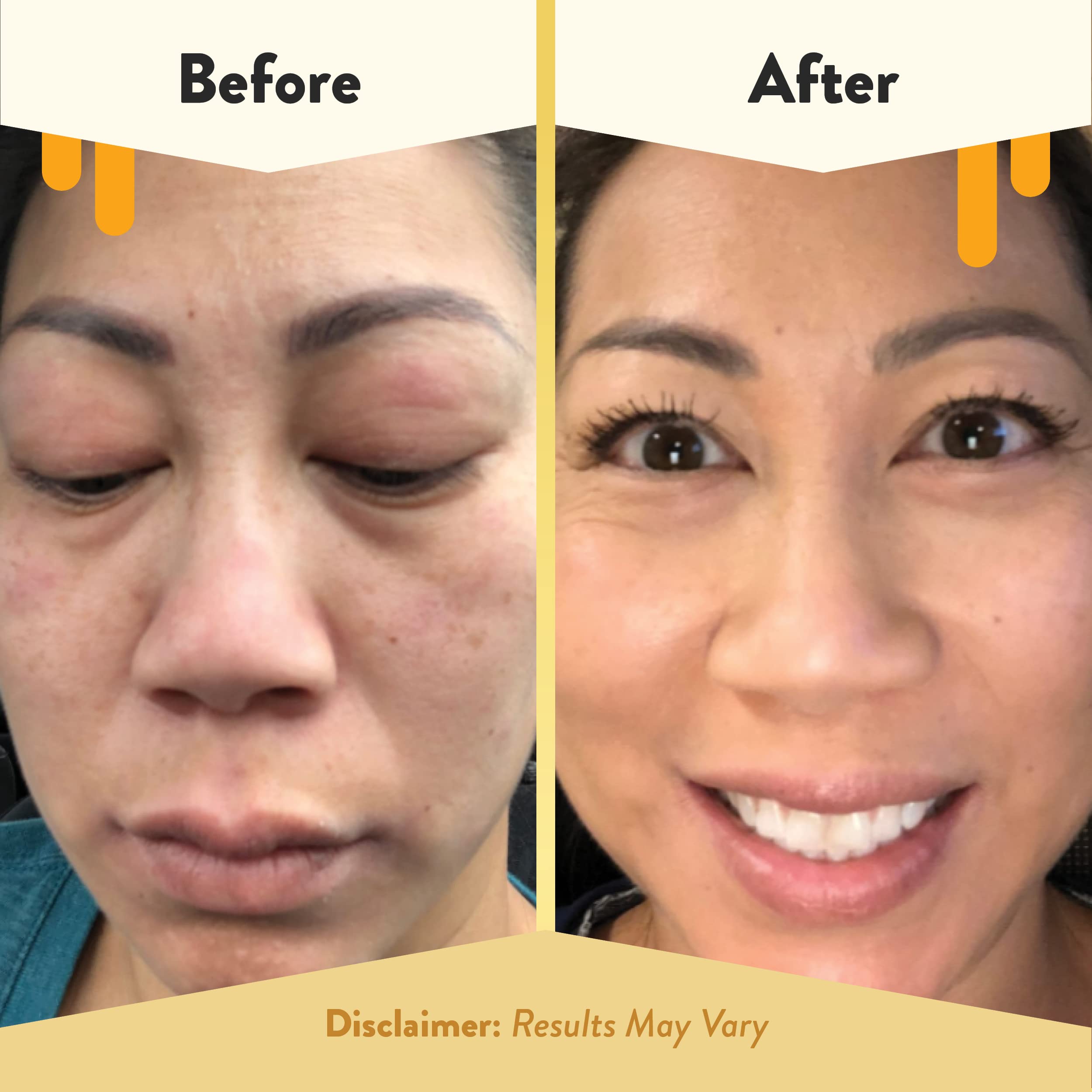 ECZEMA HONEY eyelid-area demonstrates delicate, soothing coverage for sensitive eyes