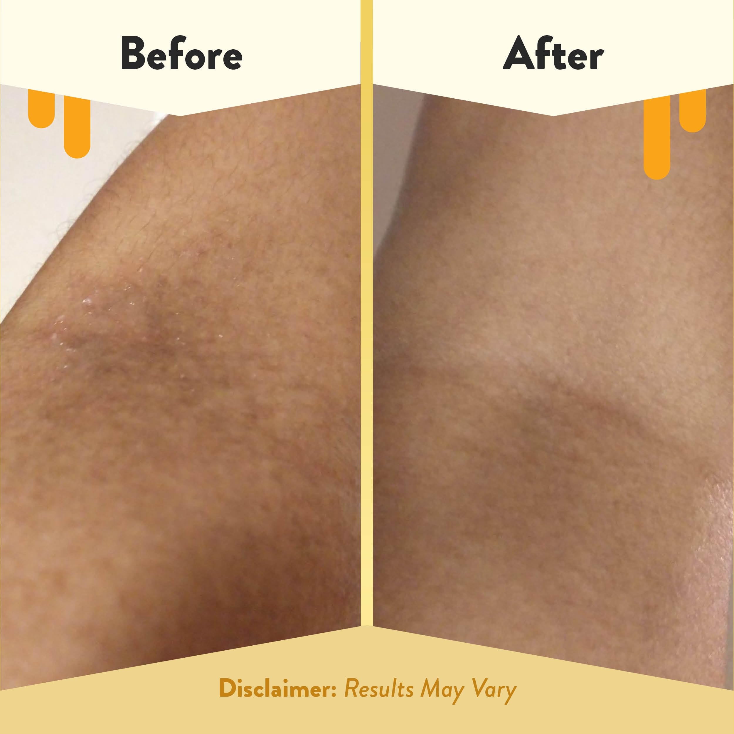 Green tea and honey ingredients on Eczema Honey label for gentle cleansing.