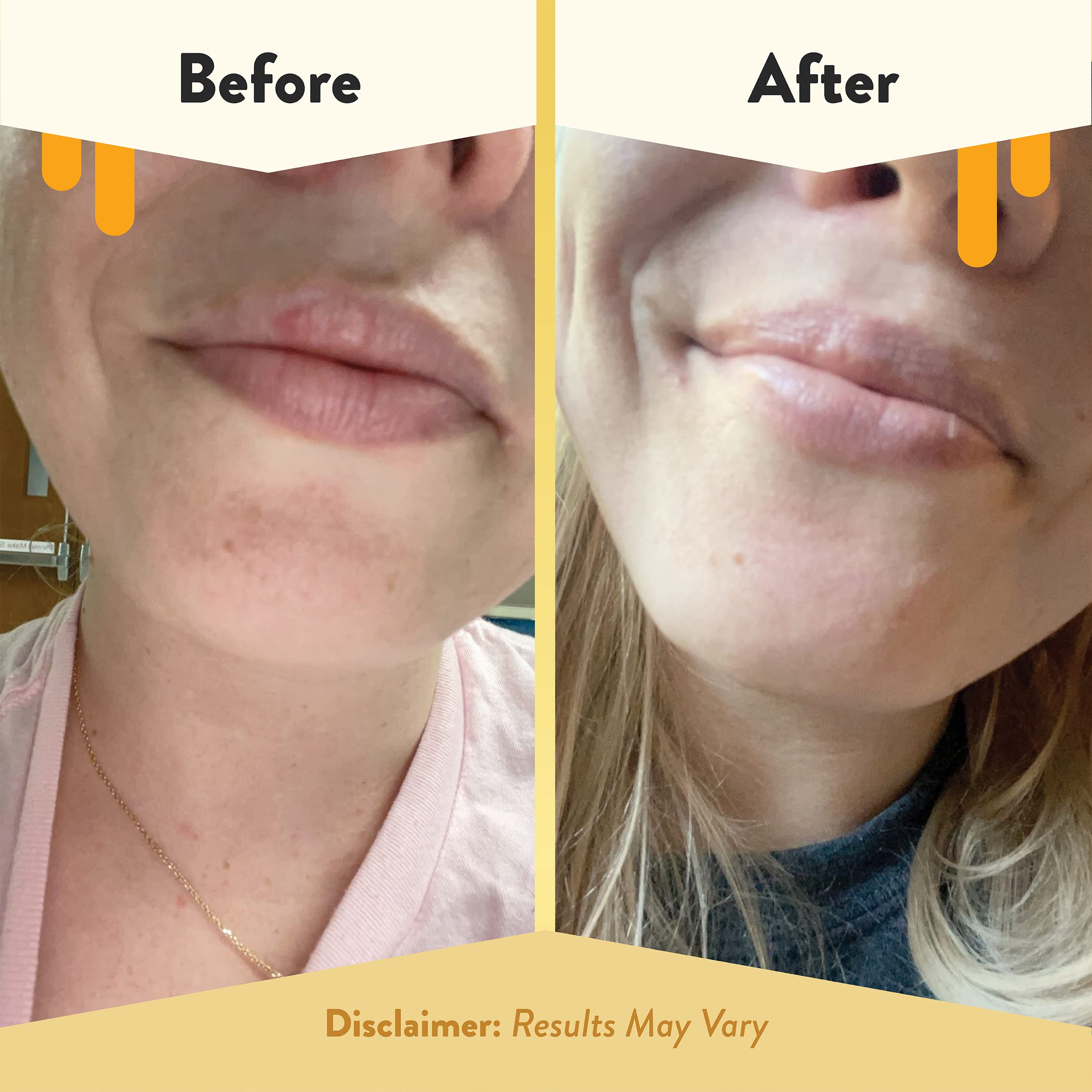 Eczema Honey Nourishing Lip Balm mango butter close-up highlighting rich moisture for very dry lips
