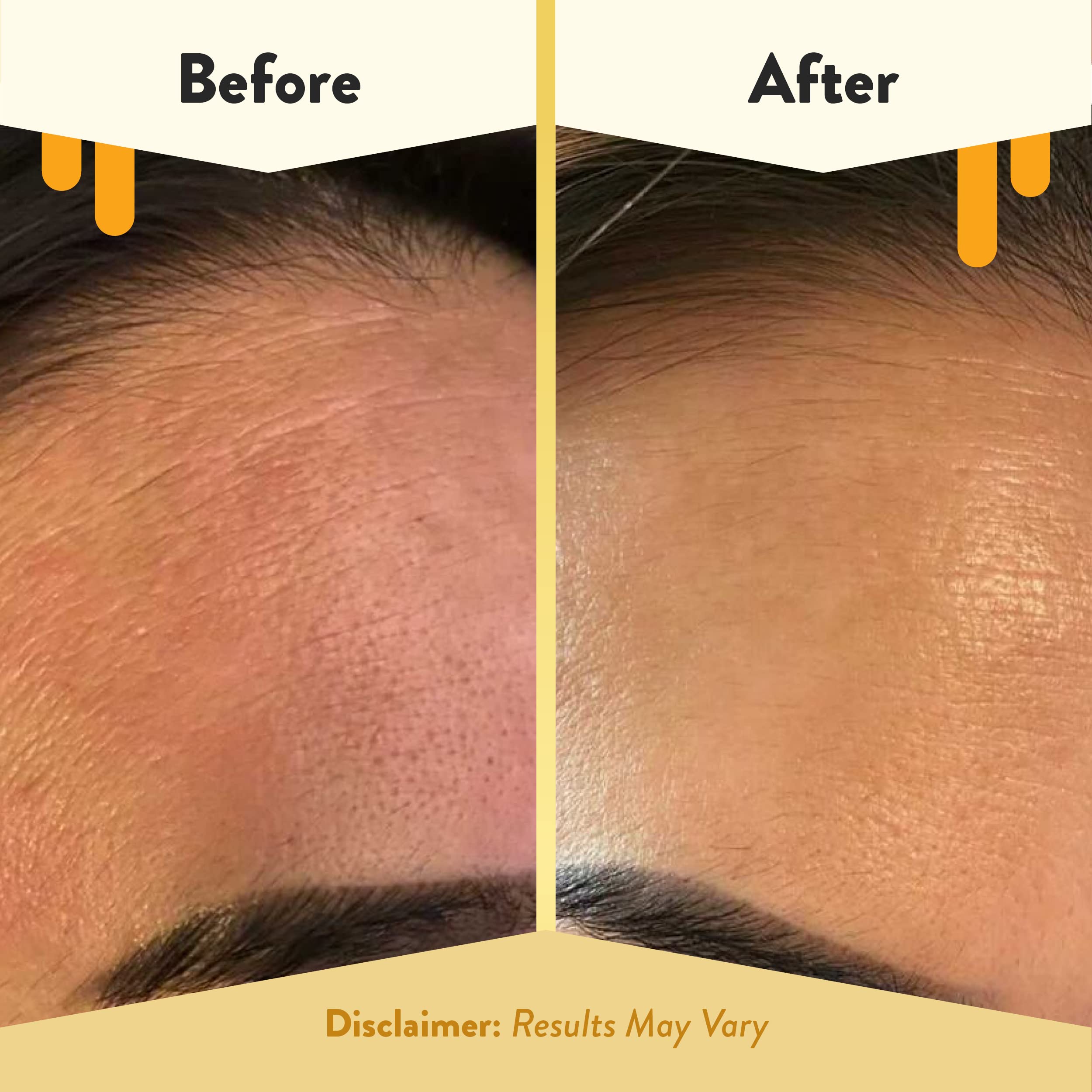 Key ingredients—honey, aloe, green tea—promoting comfort and gentle cleansing.