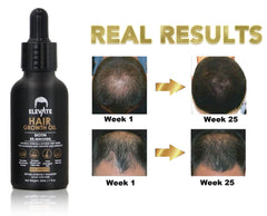 Elevate Hair Growth oil on palm illustrating easy root-to-tip massage