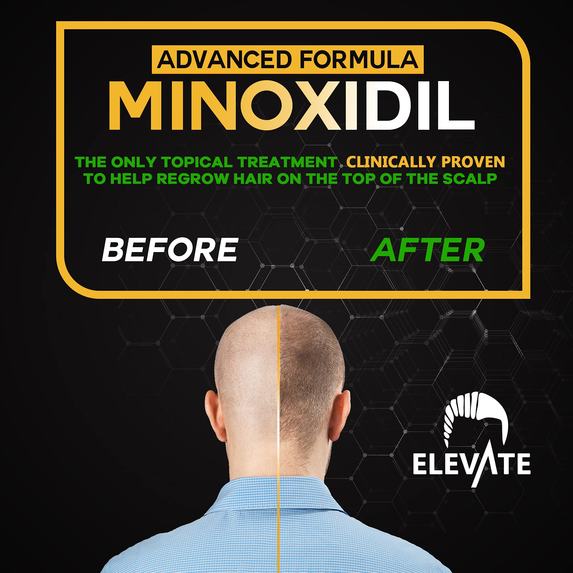 Elevate herbal infused formula bottle highlighting scalp nourishment ingredients