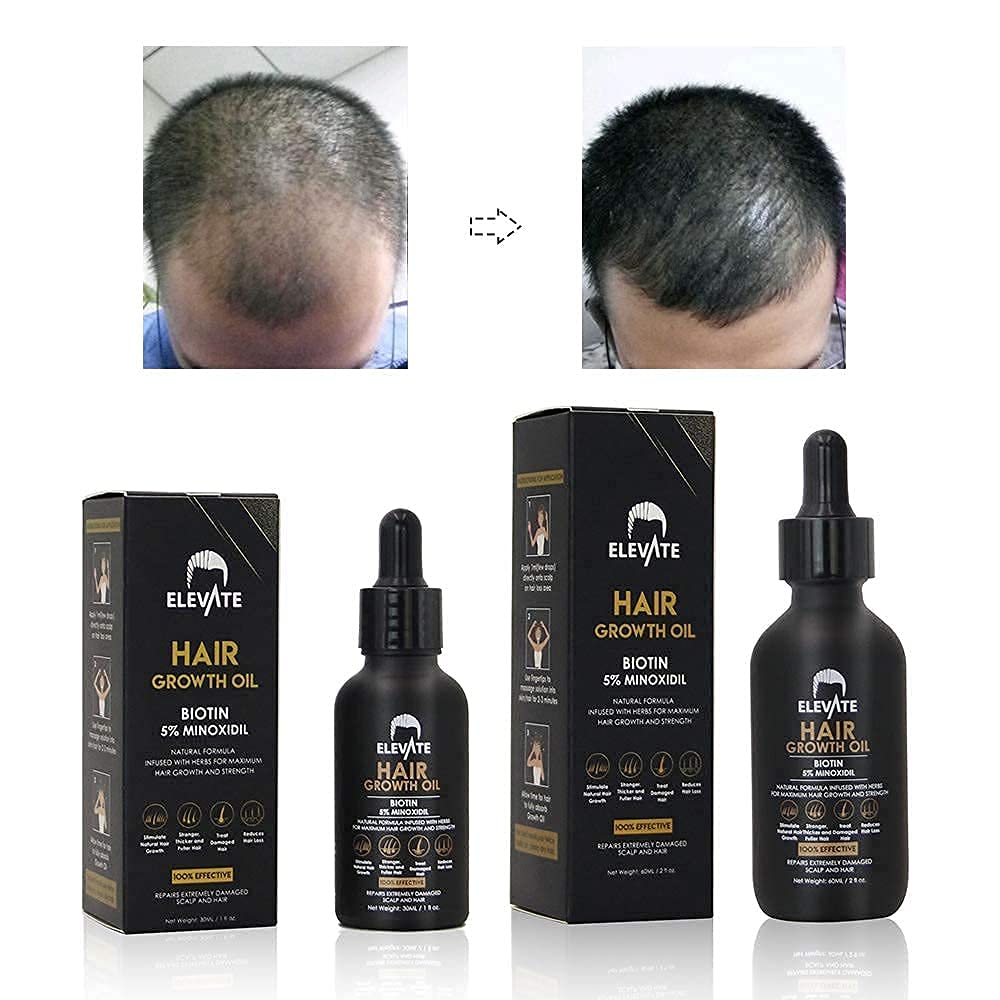 Elevate Thorough scalp care close-up emphasizing growth potential