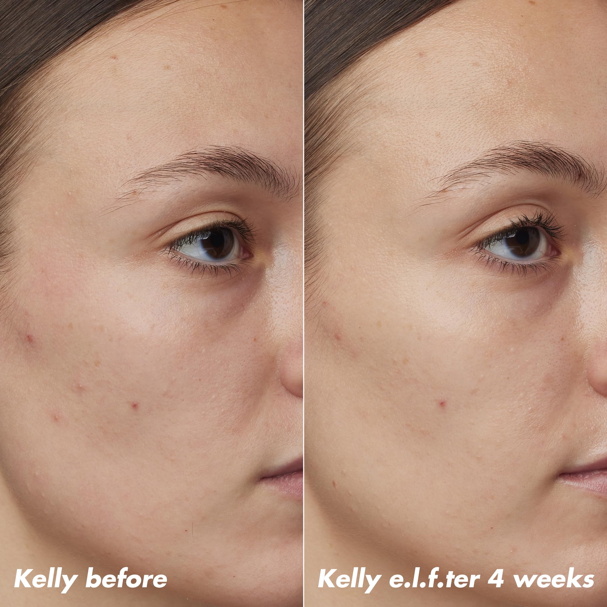 e.l.f. SKIN PLZ Clarify oil applied to clean skin for nightly acne-prone care