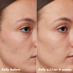 e.l.f. SKIN PLZ Clarify oil applied to clean skin for nightly acne-prone care