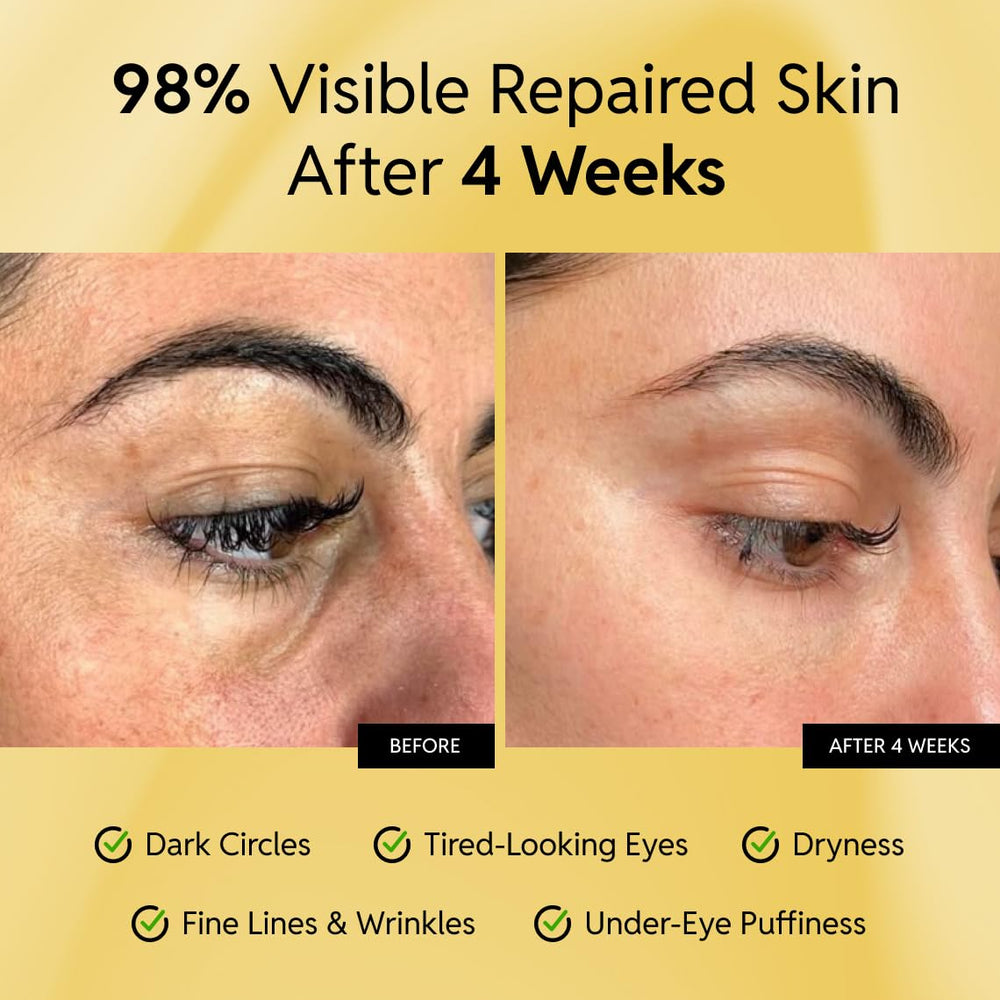 Eliré Repair Eye Cream caffeine pack close-up energizes the eye area for renewed vitality.