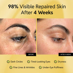 Eliré Repair Eye Cream caffeine pack close-up energizes the eye area for renewed vitality.