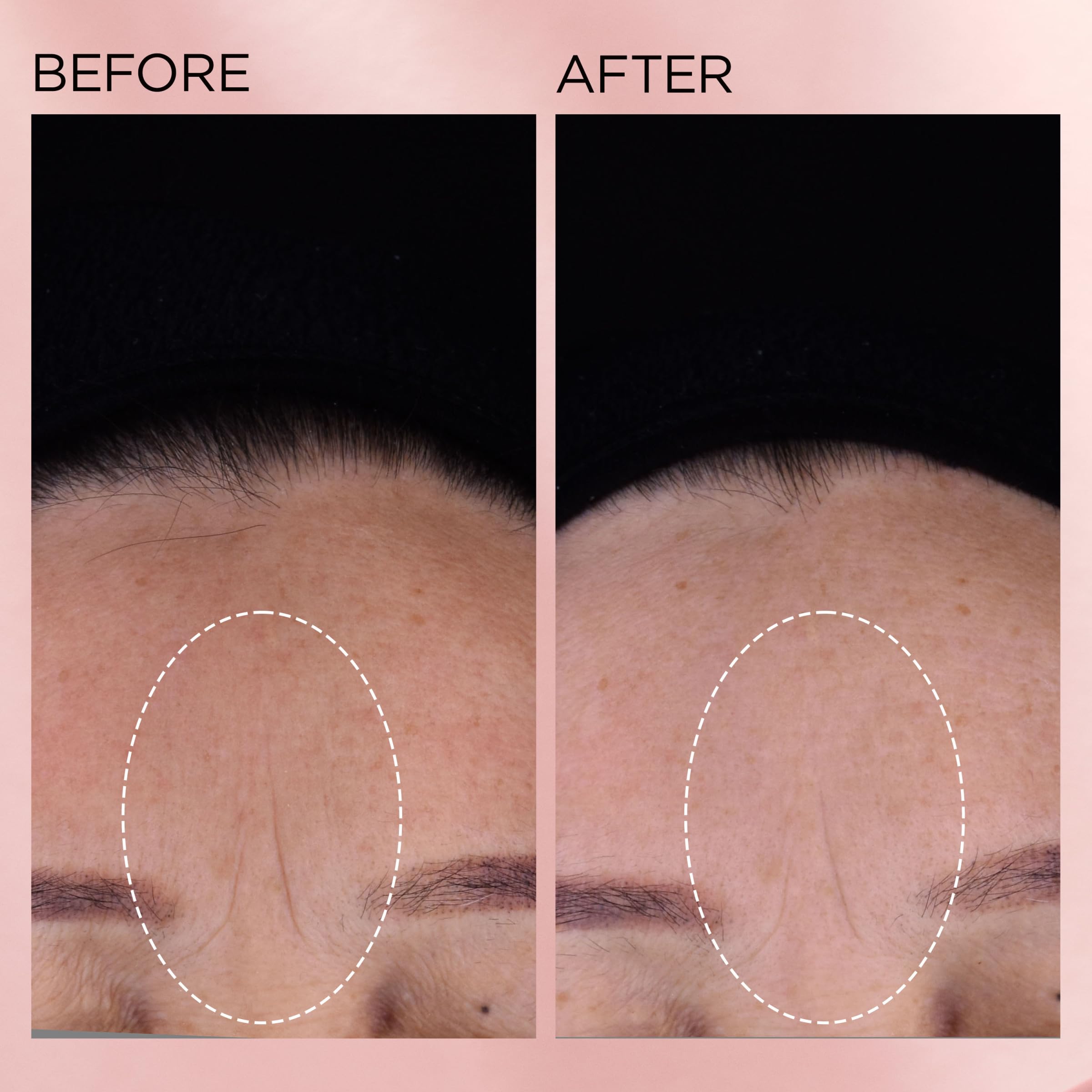 Elizabeth Arden close-up shows improved texture after consistent use.