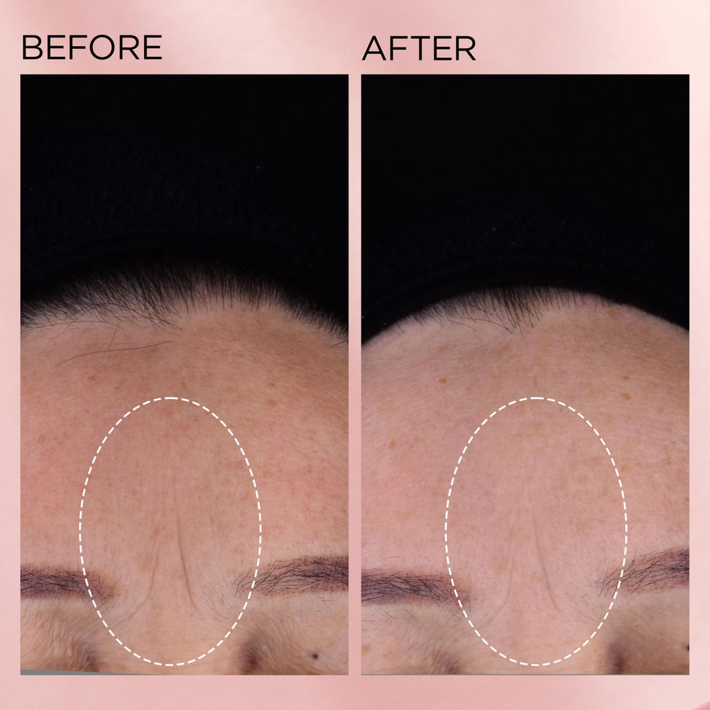 Elizabeth Arden close-up shows improved texture after consistent use.