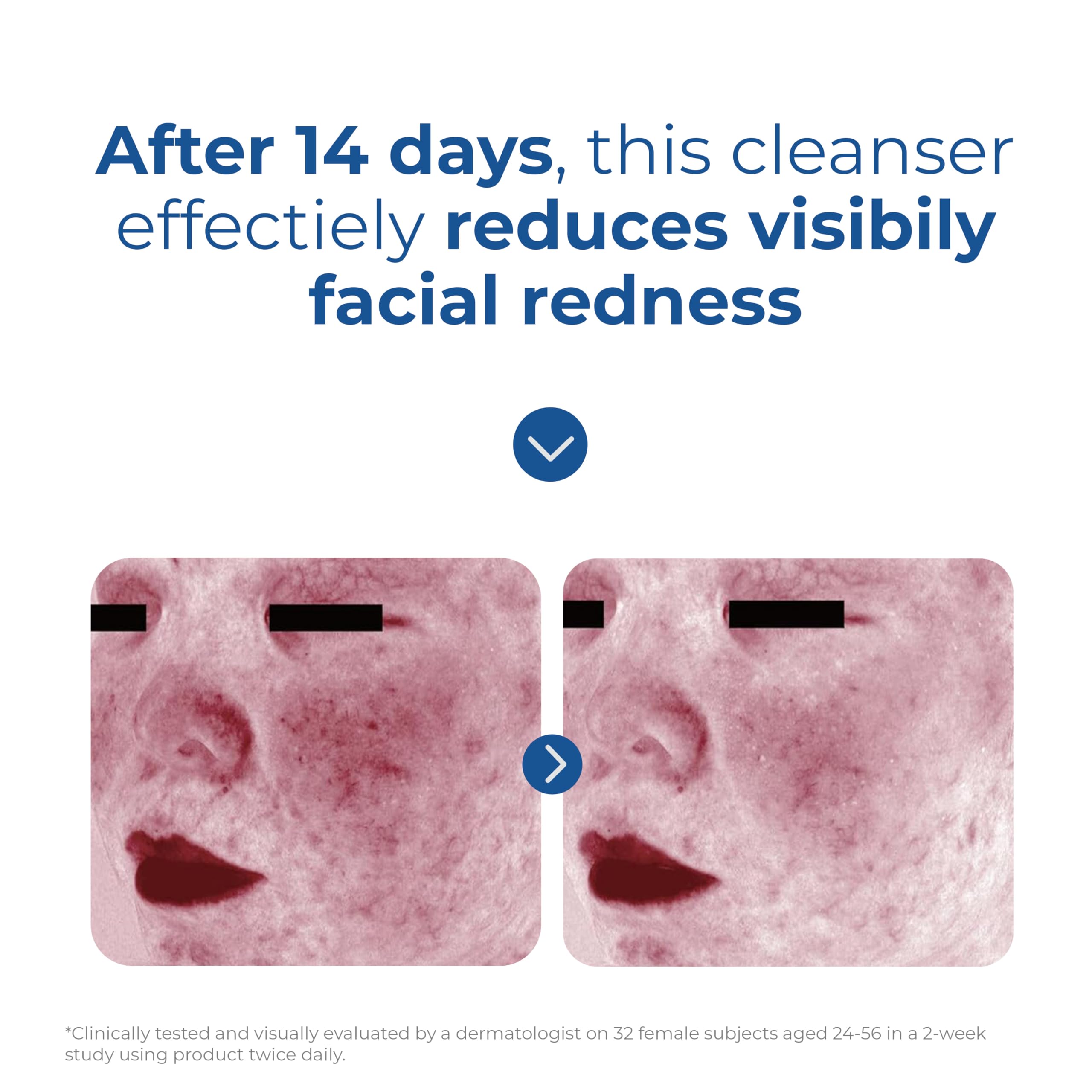 EltaMD cleanser removing light makeup and sunscreen in water stream.