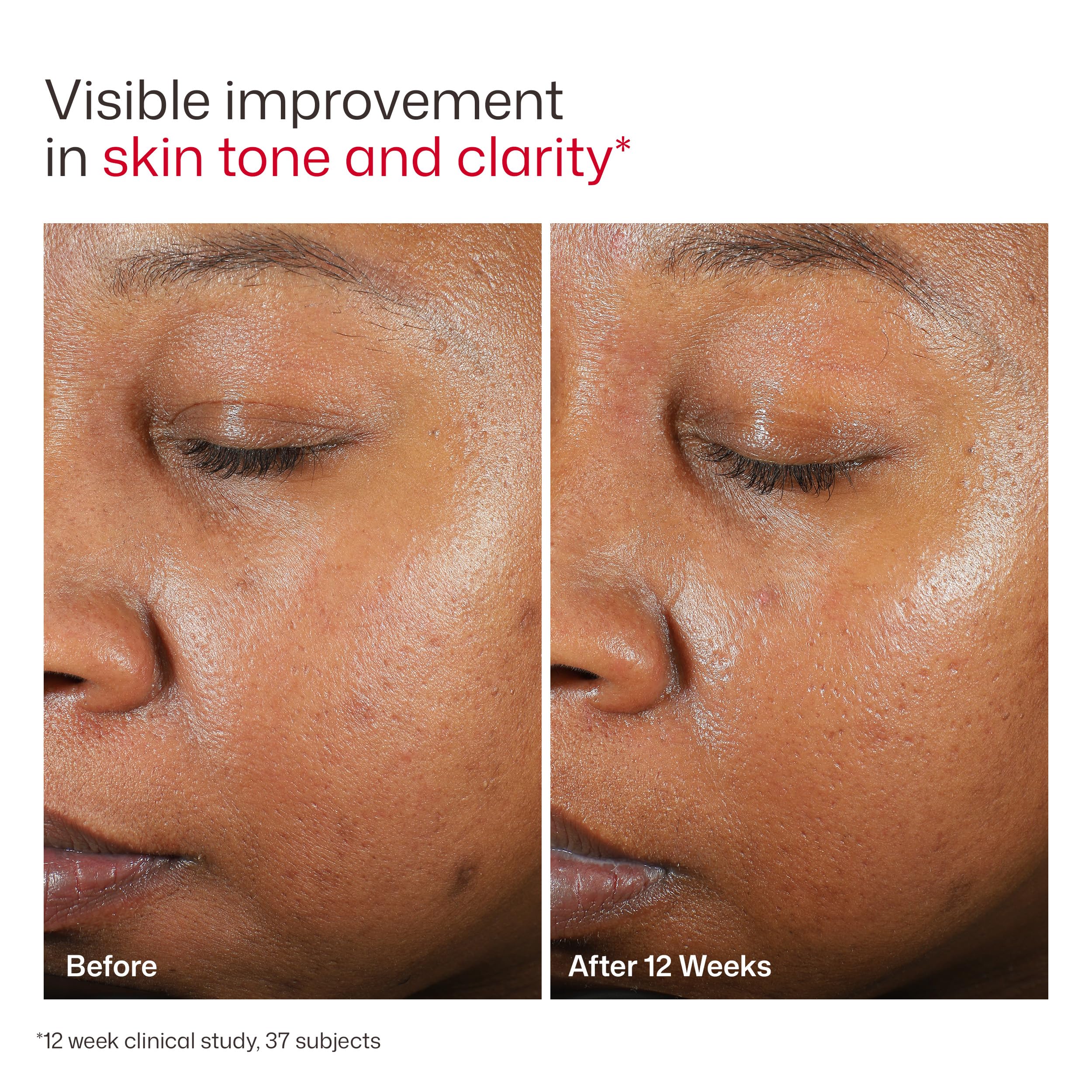 EltaMD UV Clear skin-tone friendly formula complements diverse complexions.