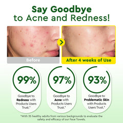 Elvira plant-based fibers deliver a soft touch for sensitive skin