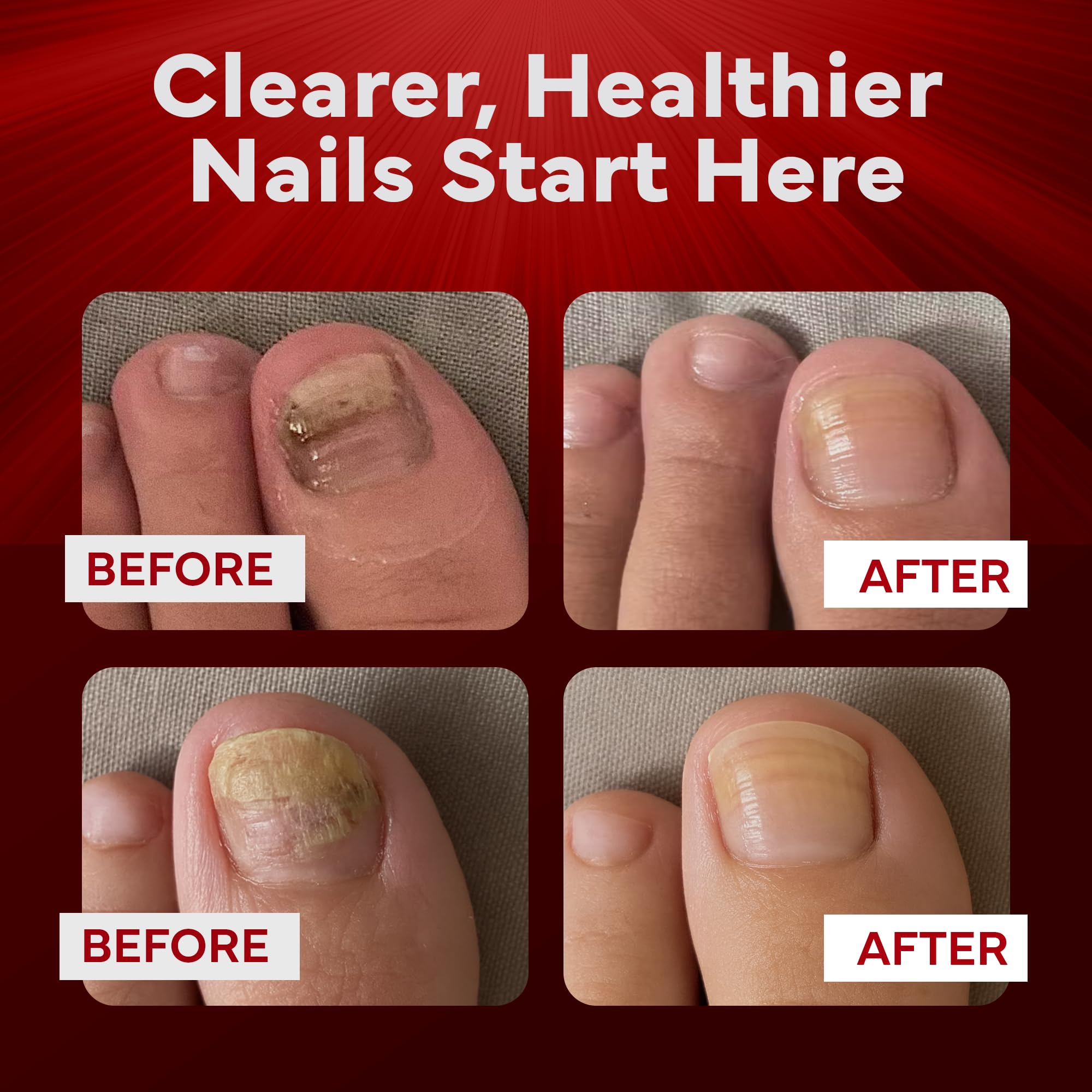 Daily nail care routine with EMUAIDMAX in use