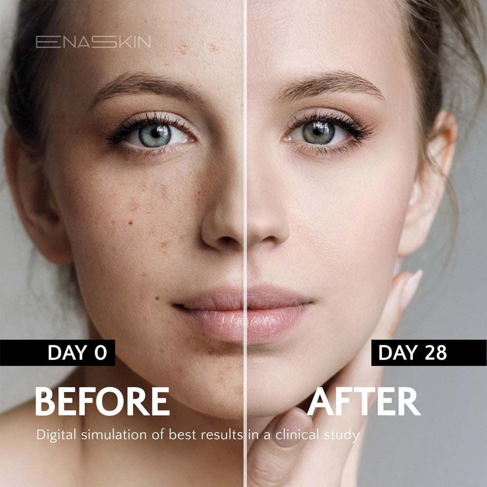 EnaSkin packaging box highlighting Niacinamide and Alpha-Arbutin
