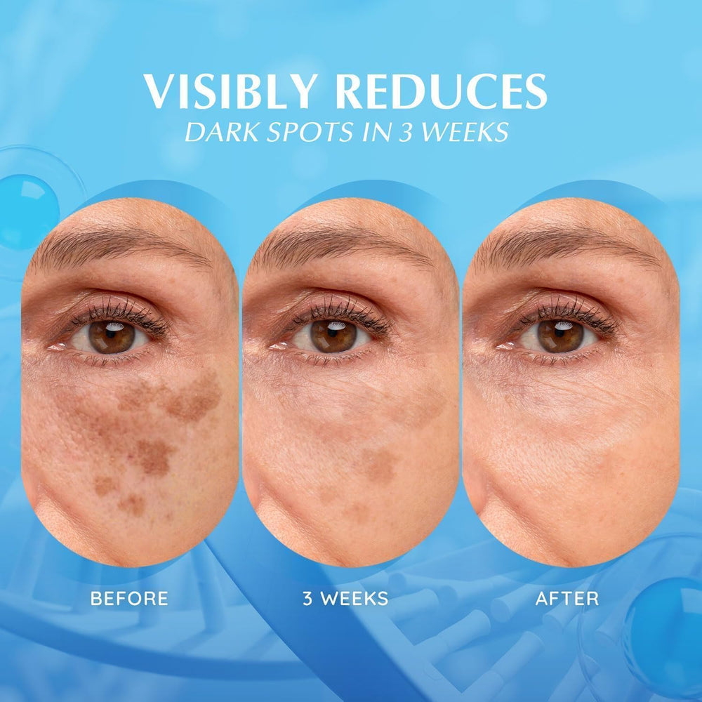 EnaSkin face closeup suggesting smoother complexion after use