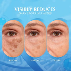EnaSkin face closeup suggesting smoother complexion after use
