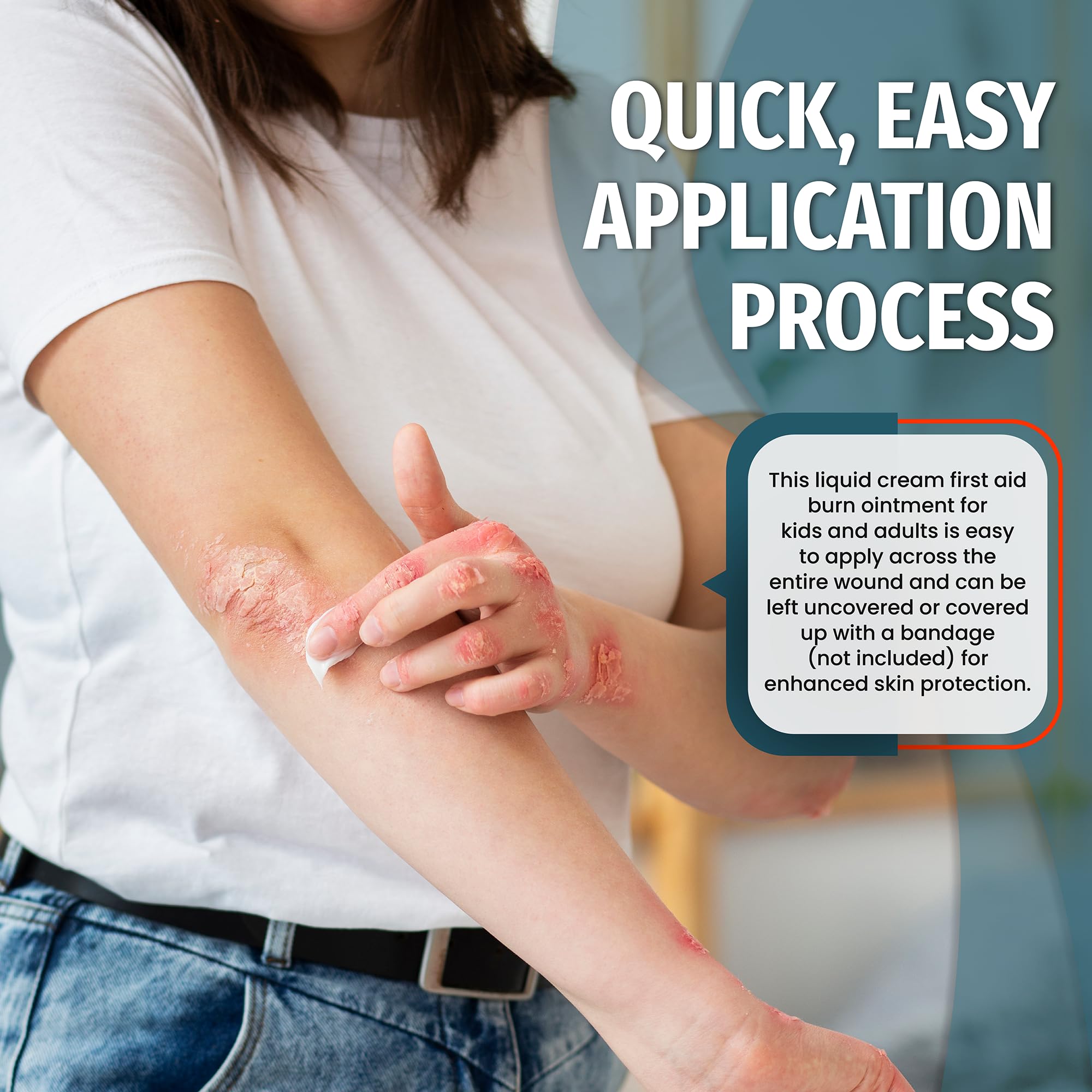 Epic Medical Supply face-application burn cream for facial skin comfort