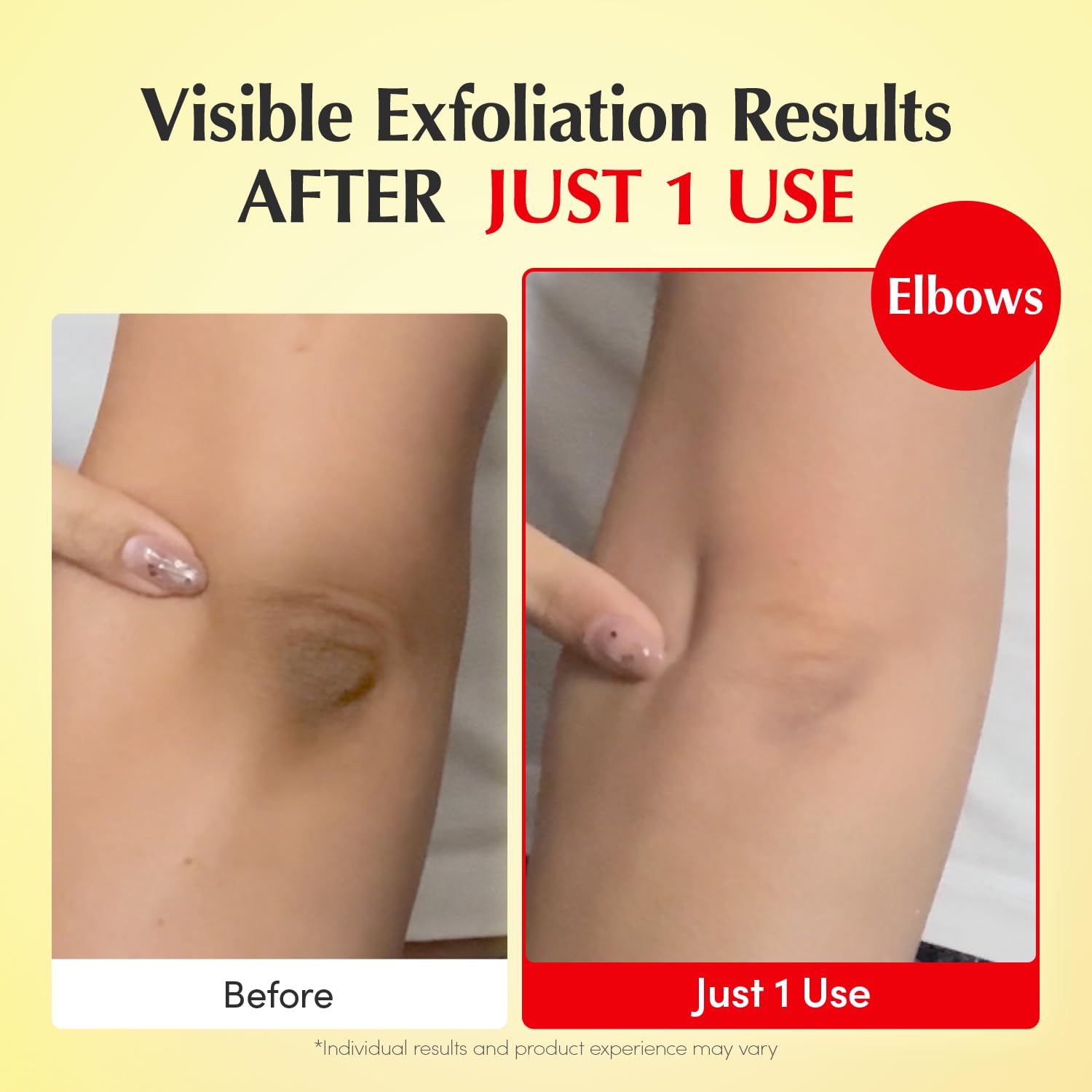 Bromelain enzyme action in EQQUALBERRY toner aiding texture refinement