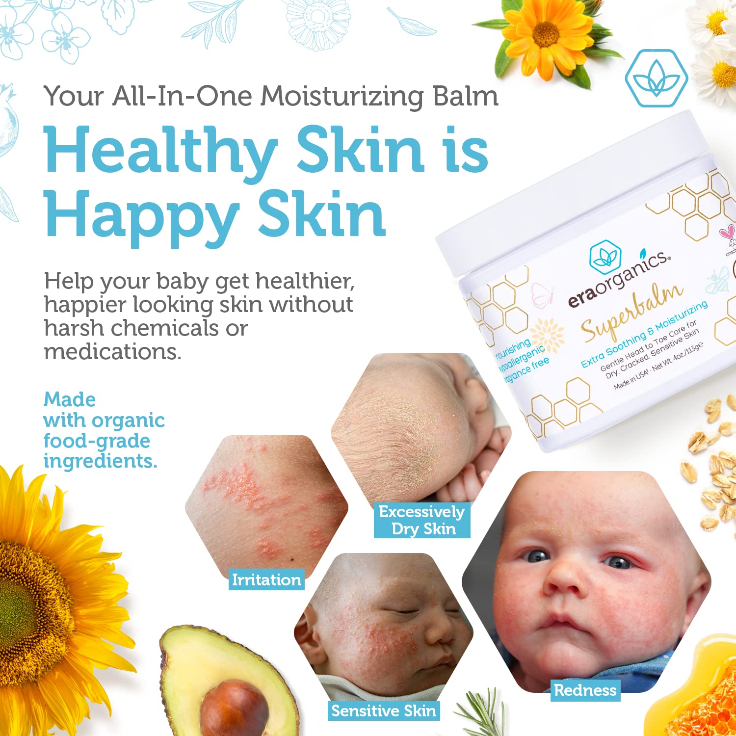 Era Organics Healing Ointment for baby eczema and cradle cap in natural care