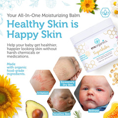 Era Organics Healing Ointment for baby eczema and cradle cap in natural care