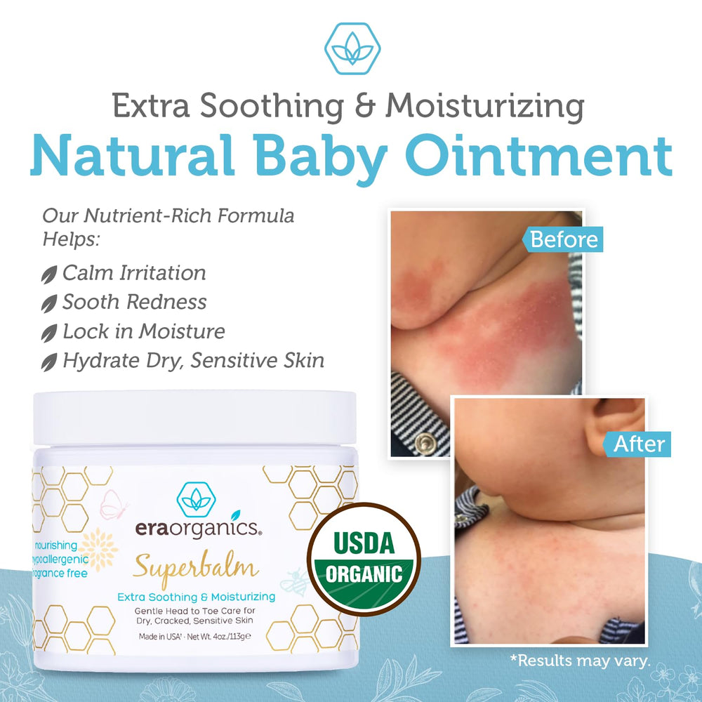 Gently massaging Era Organics Healing Ointment on baby skin for comfort