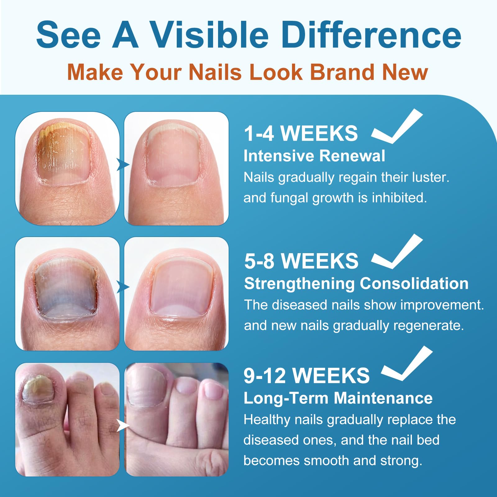 Application on a toenail with sandals-ready appearance.