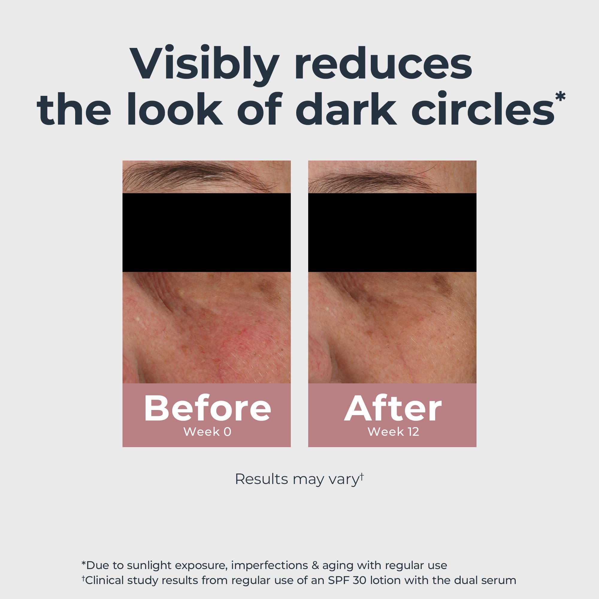 Eucerin Radiant Tone Eye Cream targets dark circles with regular use