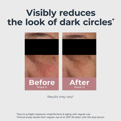 Eucerin Radiant Tone Eye Cream targets dark circles with regular use