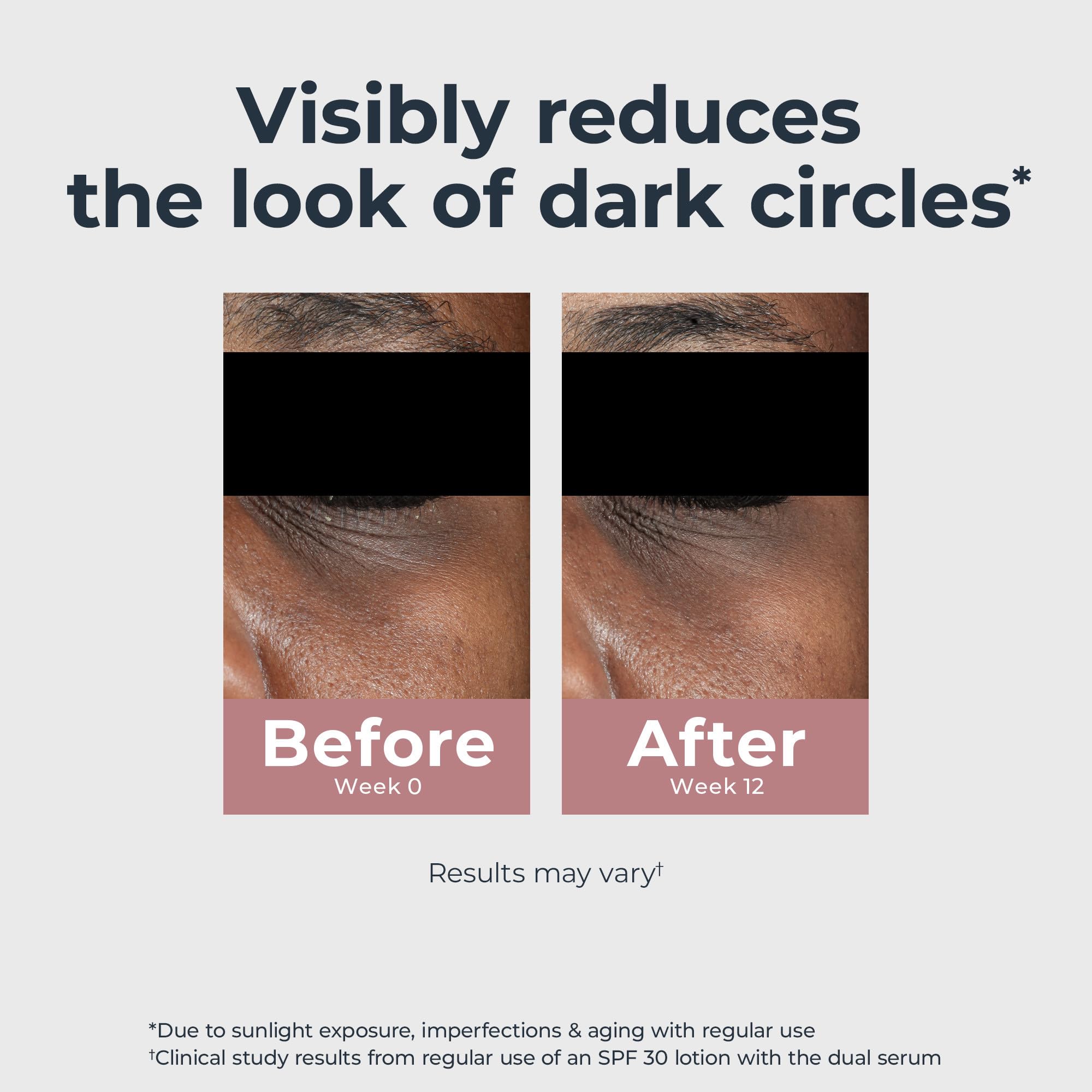 Eucerin Radiant Tone Eye Cream with light-reflecting pigments for instant brightness
