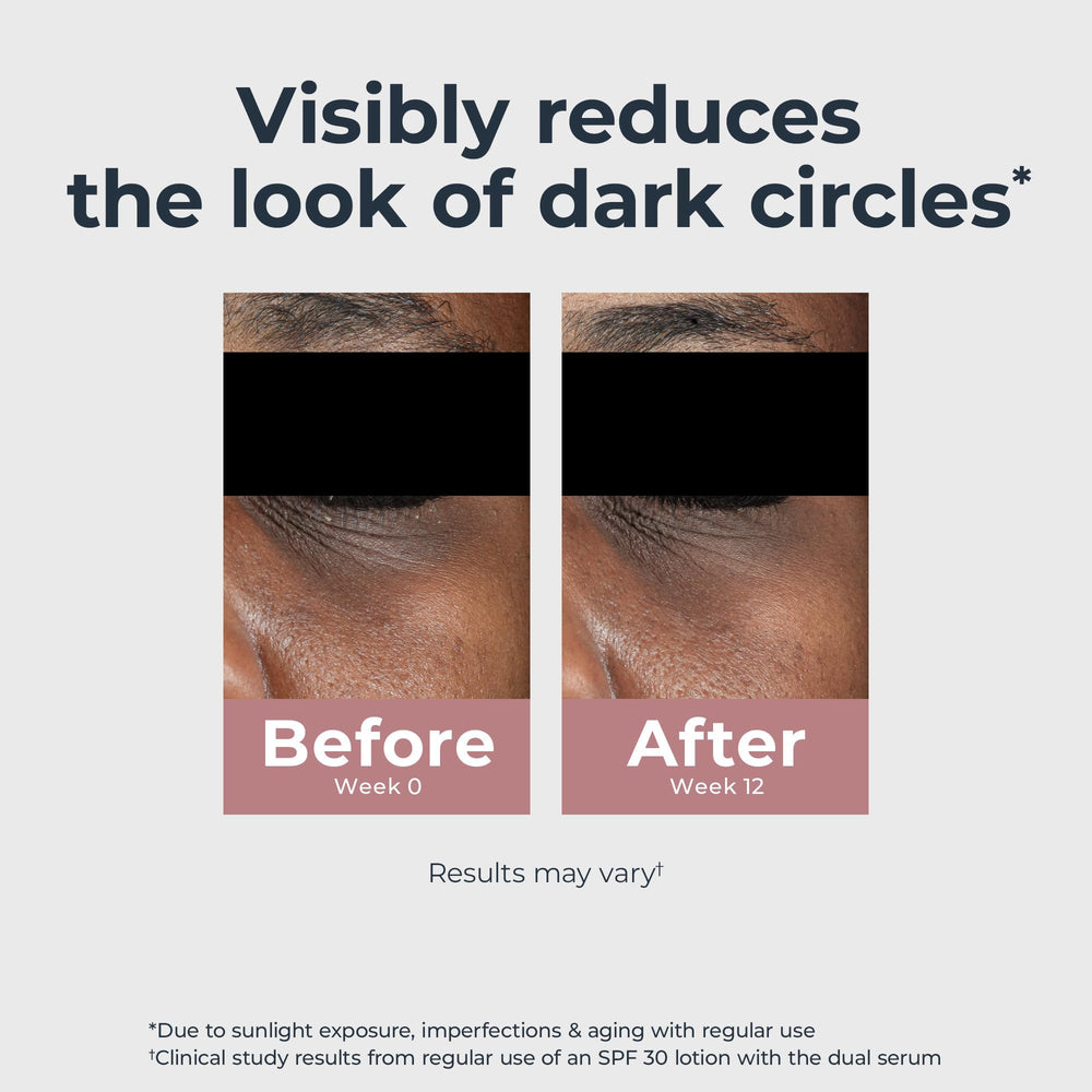 Eucerin Radiant Tone Eye Cream with light-reflecting pigments for instant brightness