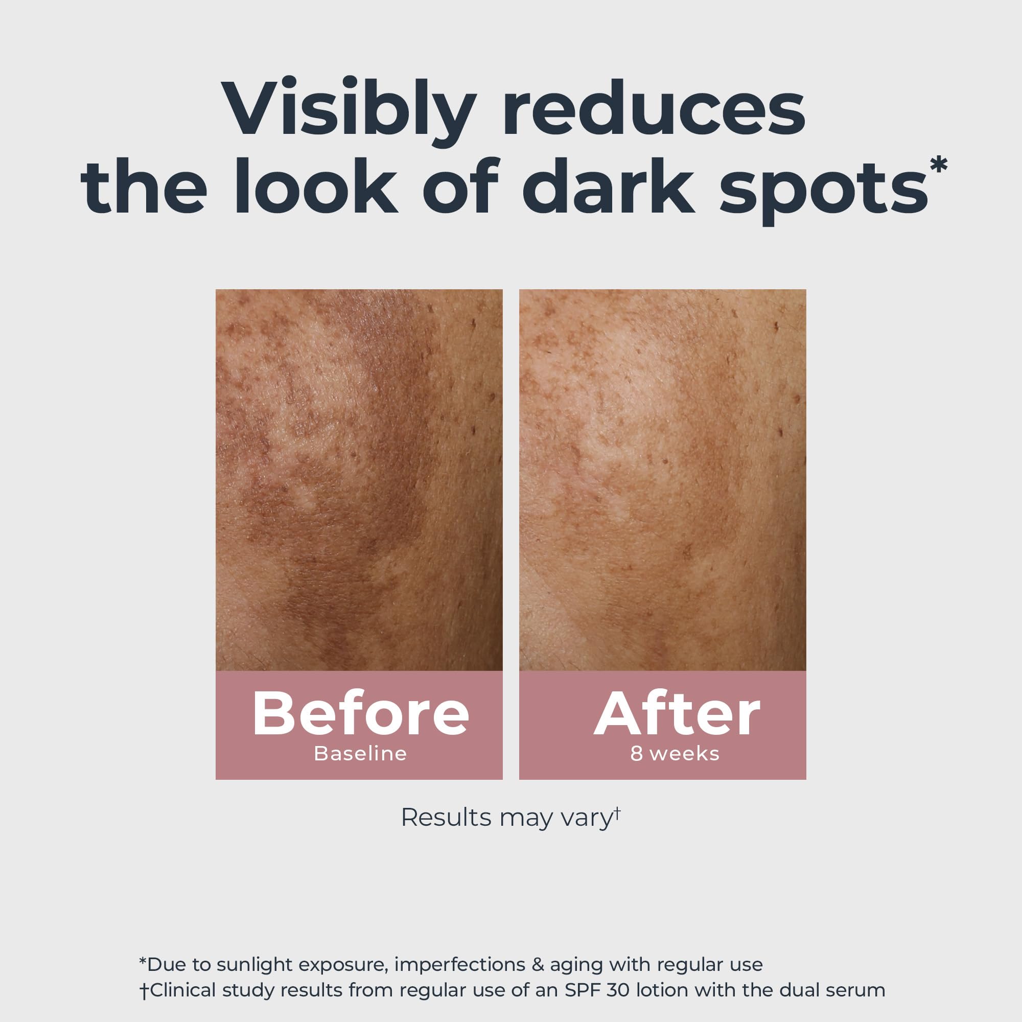 Eucerin application on cheek shows lightweight nonsticky texture