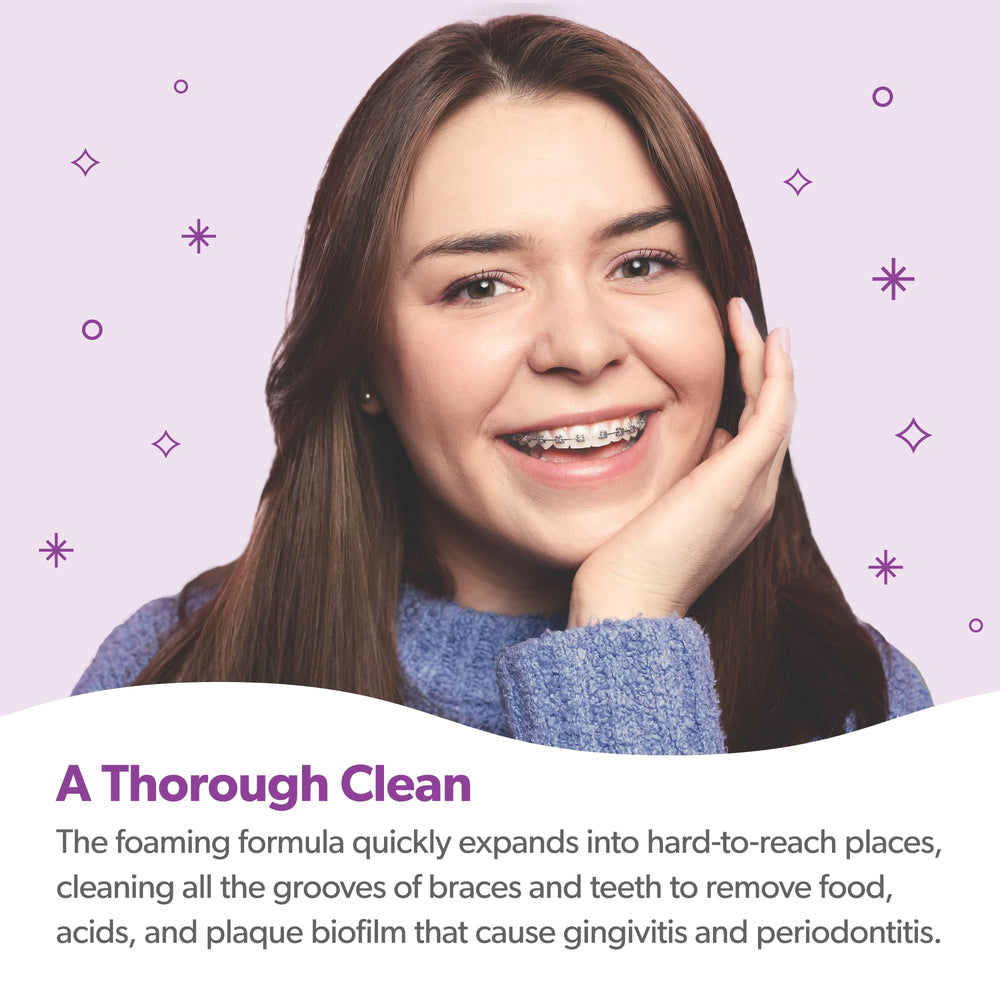 EverSmile OrthoFoam braces cleaning in mouth shows foam reaching under brackets.