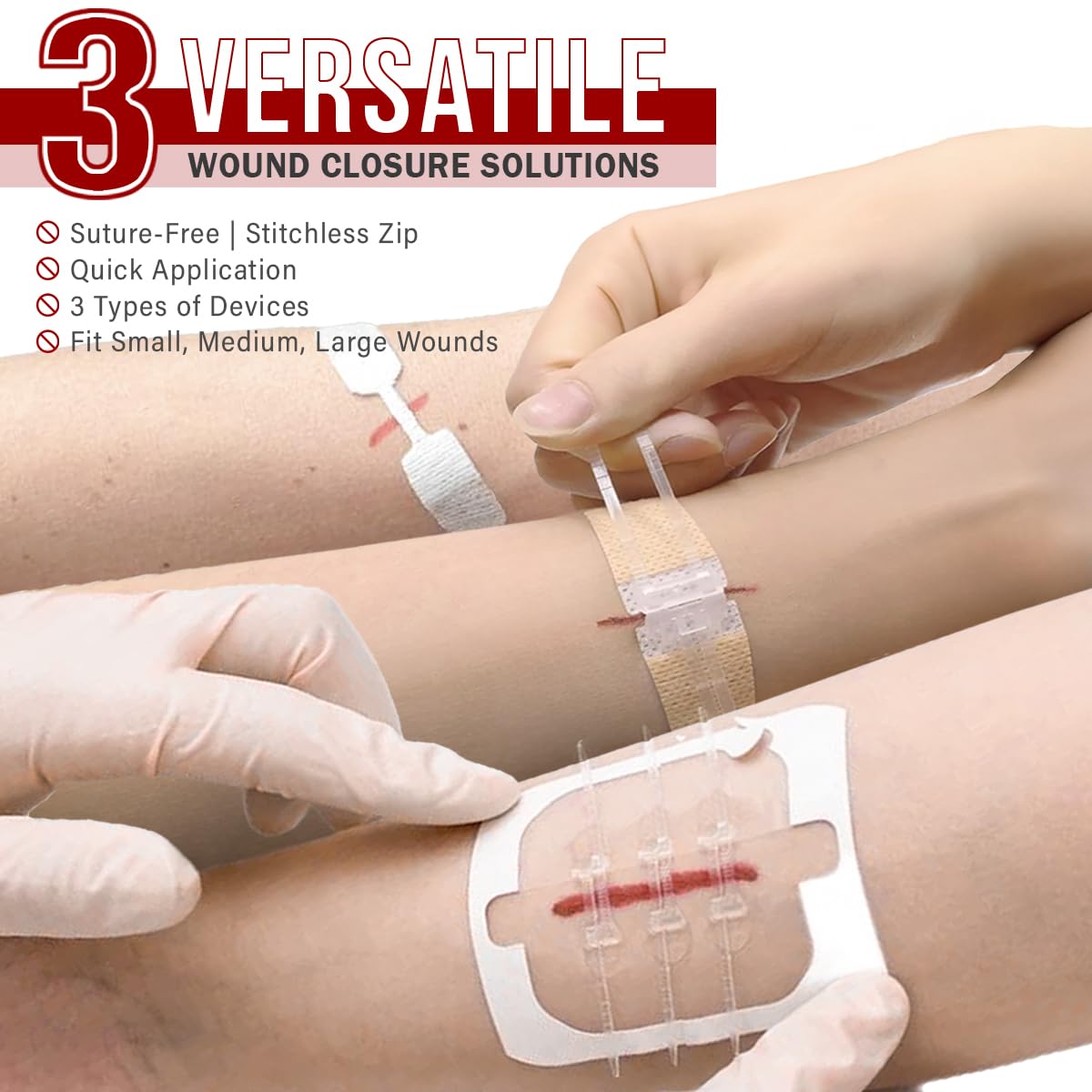 EVERLIT CARE emergency laceration closures enable rapid, tool-free wound management